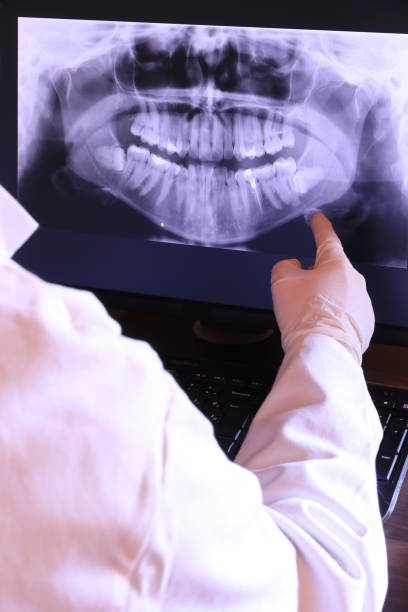 Best Chipped Tooth Repair Near Me  in Layhill, MD
